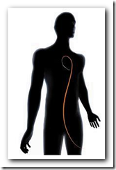 Ancient Principle Fuels Modern Heart Device - Medical Quack